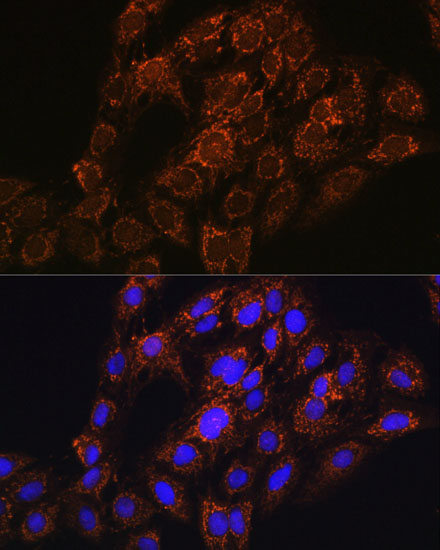 C6 cell; 4% Paraformaldehyde-fixed; Triton X-100 at room temperature for 20 min; Blocking buffer (normal goat serum, C-0005) at 37°C for 20 min; Antibody incubation with (CHCHD2 ) polyclonal Antibody, Unconjugated (bs-55042R) 1:100, 90 minutes at 37°C; followed by a conjugated Goat Anti-Rabbit IgG antibody at 37°C for 90 minutes, DAPI (blue, C02-04002) was used to stain the cell nuclei.