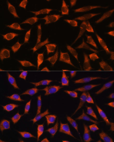 L929 cell; 4% Paraformaldehyde-fixed; Triton X-100 at room temperature for 20 min; Blocking buffer (normal goat serum, C-0005) at 37°C for 20 min; Antibody incubation with (CHCHD2) polyclonal Antibody, Unconjugated (bs-55042R) 1:100, 90 minutes at 37°C; followed by a conjugated Goat Anti-Rabbit IgG antibody at 37°C for 90 minutes, DAPI (blue, C02-04002) was used to stain the cell nuclei.