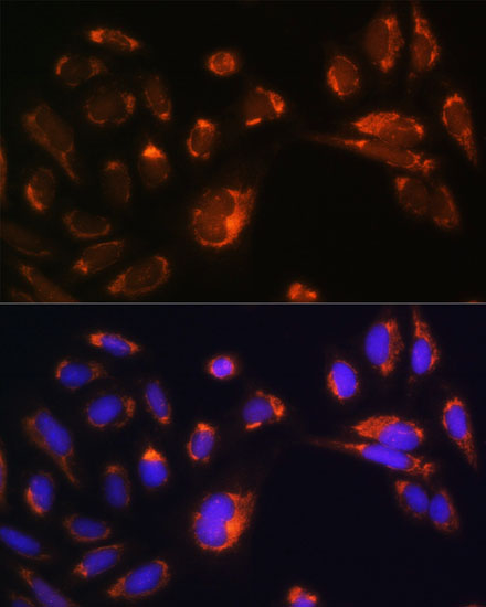 U2-OS cell; 4% Paraformaldehyde-fixed; Triton X-100 at room temperature for 20 min; Blocking buffer (normal goat serum, C-0005) at 37°C for 20 min; Antibody incubation with (CHCHD2) polyclonal Antibody, Unconjugated (bs-55042R) 1:100, 90 minutes at 37°C; followed by a conjugated Goat Anti-Rabbit IgG antibody at 37°C for 90 minutes, DAPI (blue, C02-04002) was used to stain the cell nuclei.