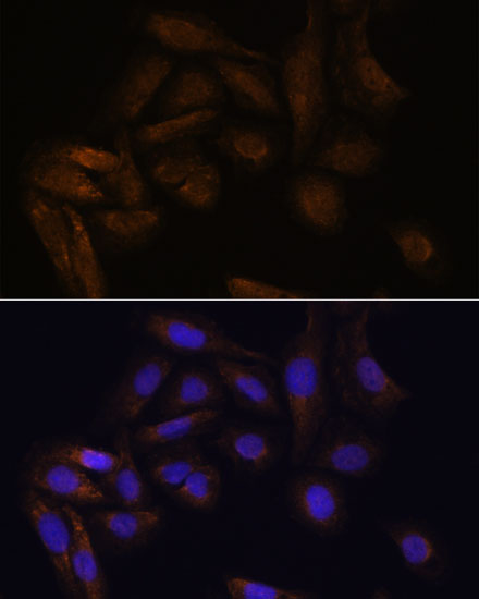 U2-OS cell; 4% Paraformaldehyde-fixed; Triton X-100 at room temperature for 20 min; Blocking buffer (normal goat serum, C-0005) at 37°C for 20 min; Antibody incubation with (TFAP4) polyclonal Antibody, Unconjugated (bs-55214R) 1:100, 90 minutes at 37°C; followed by a conjugated Goat Anti-Rabbit IgG antibody at 37°C for 90 minutes, DAPI (blue, C02-04002) was used to stain the cell nuclei.