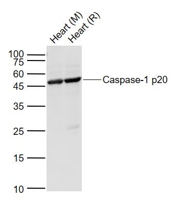 Lane 1: Mouse Heart lysates; Lane 2: Rat Heart lysates probed with Caspase-1 p20 Polyclonal Antibody, Unconjugated (bs-10442R) at 1:1000 dilution and 4˚C overnight incubation. Followed by conjugated secondary antibody incubation at 1:20000 for 60 min at 37˚C.