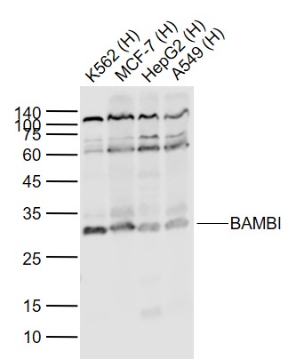 Lane 1: Human K562 cell lysates; Lane 2: Human MCF-7 cell lysates; Lane 3: Human HepG2 cell lysates; Lane 4: Human A549 cell lysates probed with BAMBI Polyclonal Antibody, Unconjugated (bs-12418R) at 1:1000 dilution and 4˚C overnight incubation. Followed by conjugated secondary antibody incubation at 1:20000 for 60 min at 37˚C.