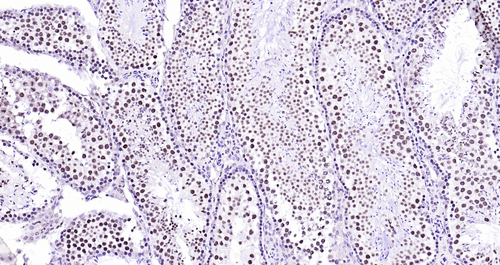 Paraformaldehyde-fixed, paraffin embedded Mouse testis; Antigen retrieval by boiling in sodium citrate buffer (pH6.0) for 15min; Block endogenous peroxidase by 3% hydrogen peroxide for 20 minutes; Blocking buffer (normal goat serum) at 37°C for 30min; Antibody incubation with Ubiquitin Monoclonal Antibody, Unconjugated (bsm-33307M) at 1:200 overnight at 4°C, DAB staining.