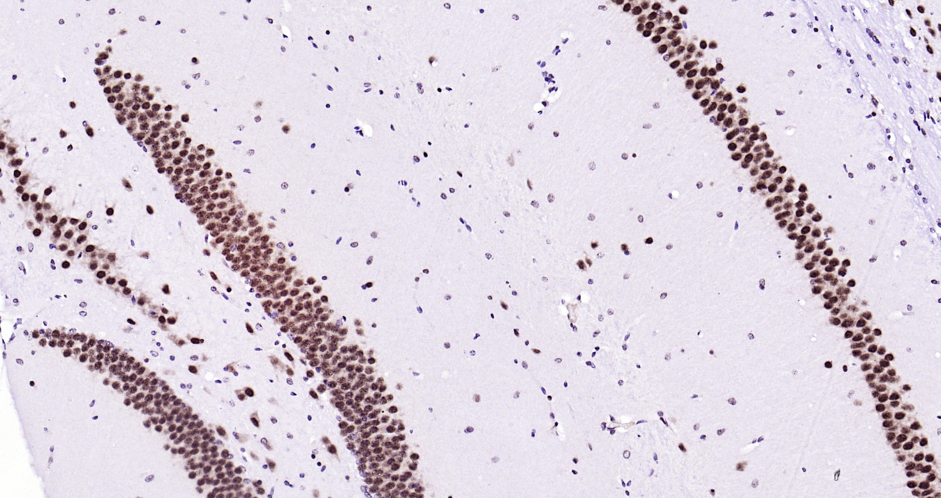 Paraformaldehyde-fixed, paraffin embedded Mouse brain; Antigen retrieval by boiling in sodium citrate buffer (pH6.0) for 15min; Block endogenous peroxidase by 3% hydrogen peroxide for 20 minutes; Blocking buffer (normal goat serum) at 37°C for 30min; Antibody incubation with Ubiquitin Monoclonal Antibody, Unconjugated (bsm-33307M) at 1:200 overnight at 4°C, DAB staining.