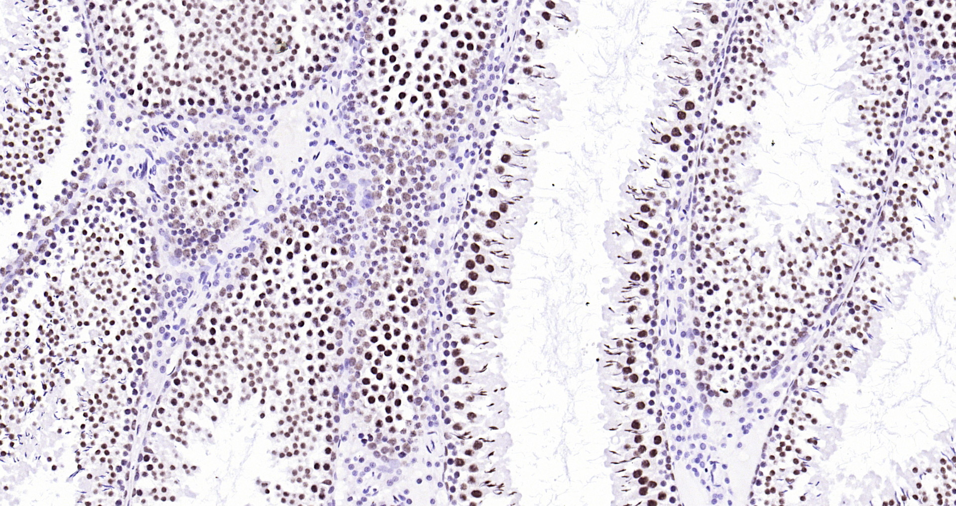 Paraformaldehyde-fixed, paraffin embedded Rat testis; Antigen retrieval by boiling in sodium citrate buffer (pH6.0) for 15min; Block endogenous peroxidase by 3% hydrogen peroxide for 20 minutes; Blocking buffer (normal goat serum) at 37°C for 30min; Antibody incubation with Ubiquitin Monoclonal Antibody, Unconjugated (bsm-33307M) at 1:200 overnight at 4°C, DAB staining.
