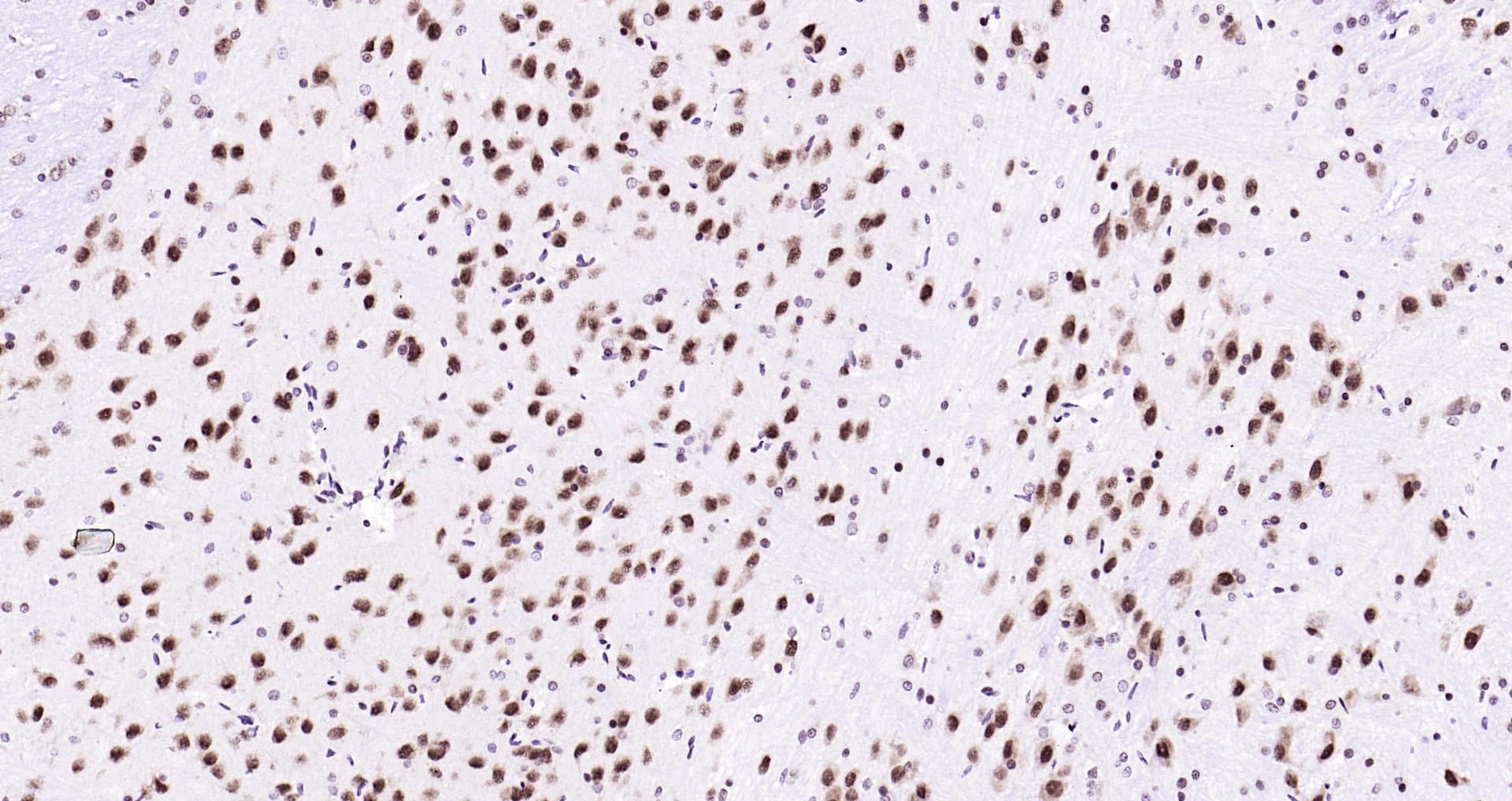 Paraformaldehyde-fixed, paraffin embedded Rat brain; Antigen retrieval by boiling in sodium citrate buffer (pH6.0) for 15min; Block endogenous peroxidase by 3% hydrogen peroxide for 20 minutes; Blocking buffer (normal goat serum) at 37°C for 30min; Antibody incubation with Ubiquitin Monoclonal Antibody, Unconjugated (bsm-33307M) at 1:200 overnight at 4°C, DAB staining.