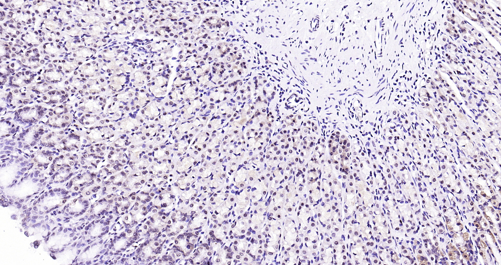 Paraformaldehyde-fixed, paraffin embedded Rat stomach; Antigen retrieval by boiling in sodium citrate buffer (pH6.0) for 15min; Block endogenous peroxidase by 3% hydrogen peroxide for 20 minutes; Blocking buffer (normal goat serum) at 37°C for 30min; Antibody incubation with Ubiquitin Monoclonal Antibody, Unconjugated (bsm-33307M) at 1:200 overnight at 4°C, DAB staining.
