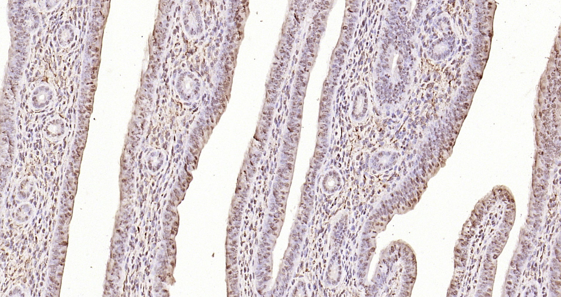 Paraformaldehyde-fixed, paraffin embedded Mouse uterus; Antigen retrieval by boiling in sodium citrate buffer (pH6.0) for 15min; Block endogenous peroxidase by 3% hydrogen peroxide for 20 minutes; Blocking buffer (normal goat serum) at 37°C for 30min; Antibody incubation with LSM6 Polyclonal Antibody, Unconjugated (bs-18431R) at 1:200 overnight at 4°C, DAB staining.