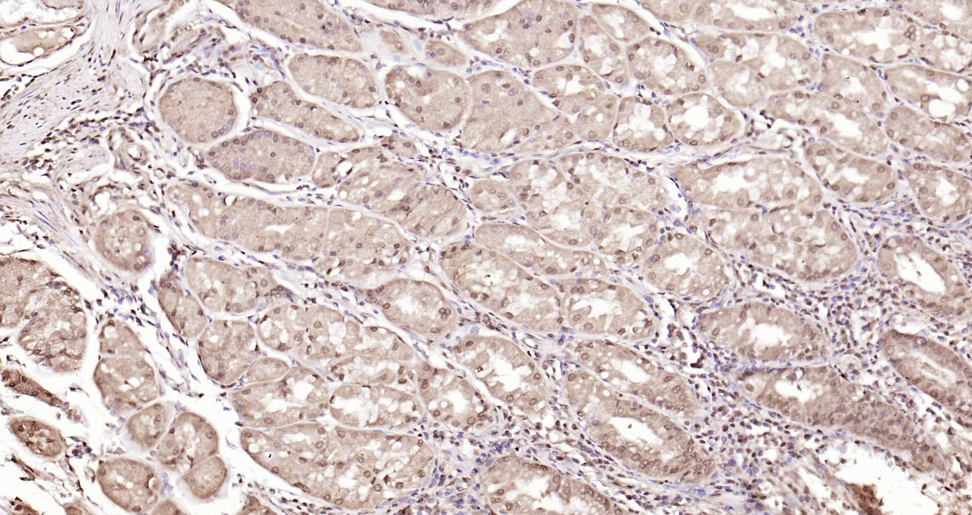 Paraformaldehyde-fixed, paraffin embedded Human stomach; Antigen retrieval by boiling in sodium citrate buffer (pH6.0) for 15min; Block endogenous peroxidase by 3% hydrogen peroxide for 20 minutes; Blocking buffer (normal goat serum) at 37°C for 30min; Antibody incubation with LSM6 Polyclonal Antibody, Unconjugated (bs-18431R) at 1:200 overnight at 4°C, DAB staining.