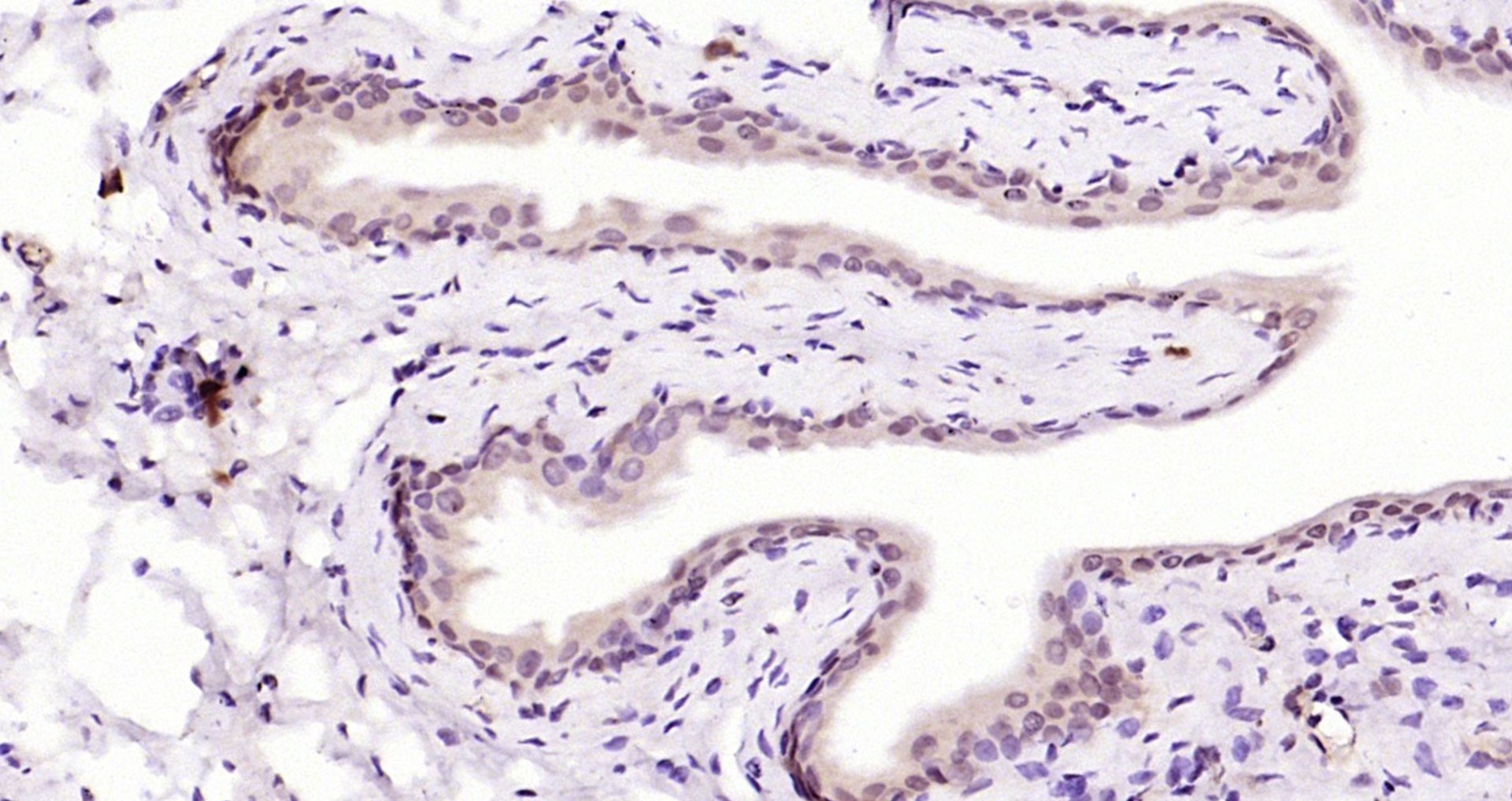 Paraformaldehyde-fixed, paraffin embedded Rat bladder; Antigen retrieval by boiling in sodium citrate buffer (pH6.0) for 15min; Block endogenous peroxidase by 3% hydrogen peroxide for 20 minutes; Blocking buffer (normal goat serum) at 37°C for 30min; Antibody incubation with HMG4/HMGB3 Polyclonal Antibody, Unconjugated (bs-8809R) at 1:200 overnight at 4°C, DAB staining.