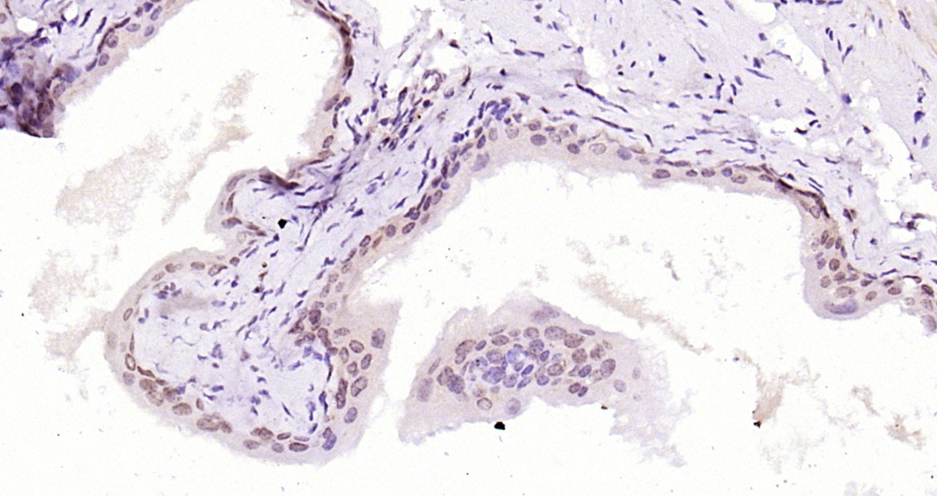 Paraformaldehyde-fixed, paraffin embedded Mouse bladder; Antigen retrieval by boiling in sodium citrate buffer (pH6.0) for 15min; Block endogenous peroxidase by 3% hydrogen peroxide for 20 minutes; Blocking buffer (normal goat serum) at 37°C for 30min; Antibody incubation with HMG4/HMGB3 Polyclonal Antibody, Unconjugated (bs-8809R) at 1:200 overnight at 4°C, DAB staining.