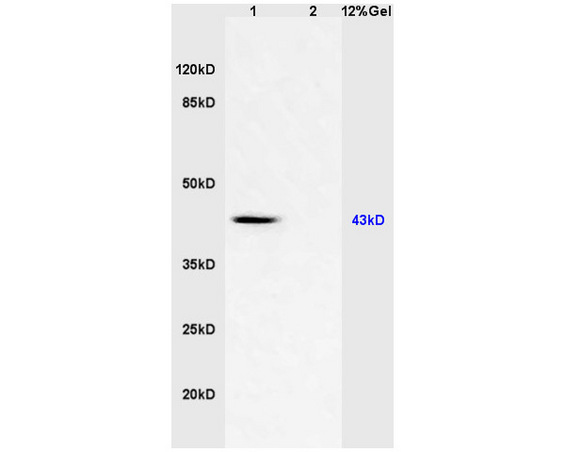 L1 mouse brain lysates L2 human colon carcinoma lysates probed with Anti CD46/MCP Polyclonal Antibody, Unconjugated (bs-1529R) at 1:200 in 4˚C. Followed by conjugation to secondary antibody (bs-0295G-HRP) at 1:3000 90min in 37˚C. Predicted band 43kD. Observed band size: 43kD