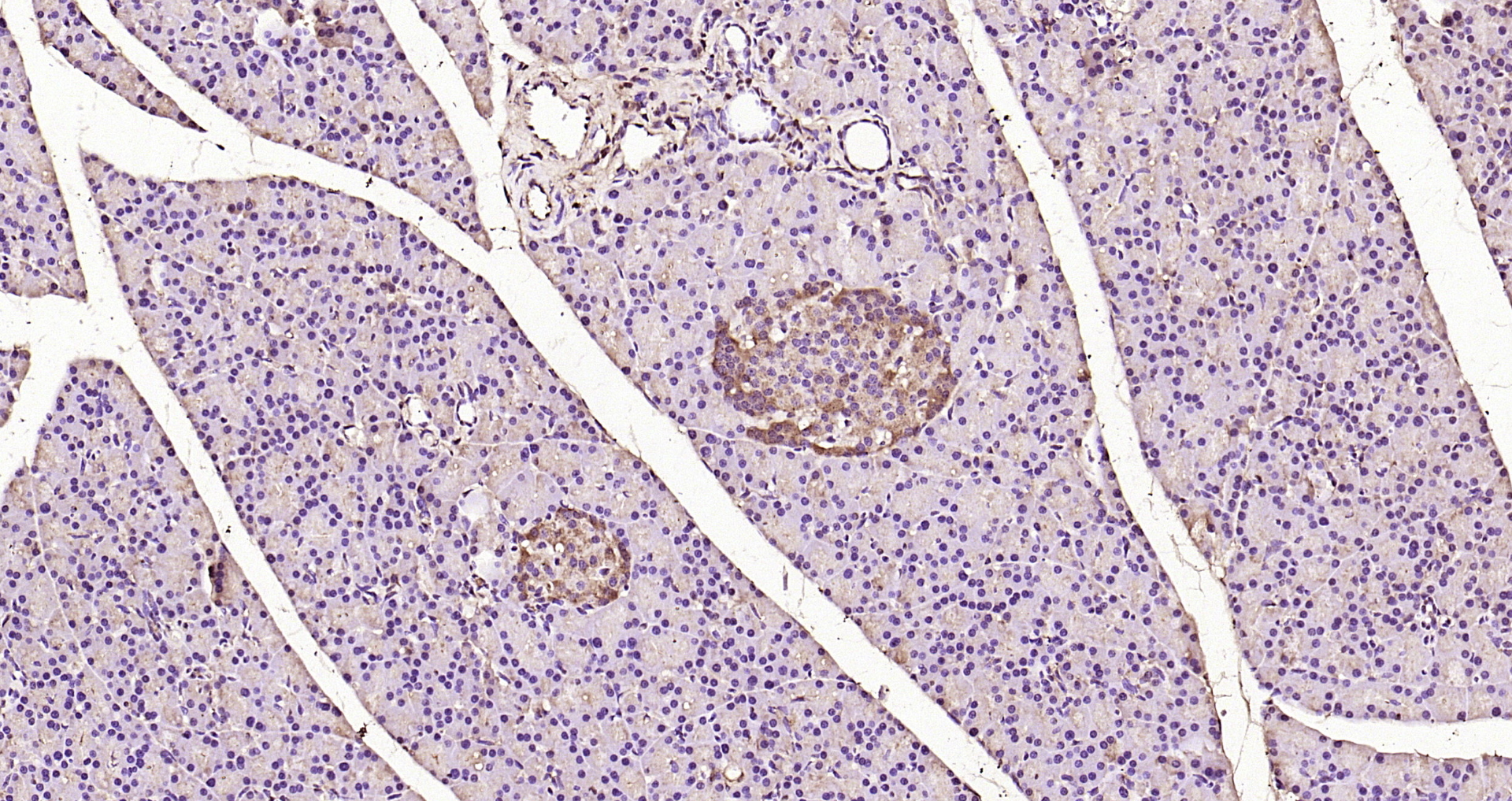 Paraformaldehyde-fixed, paraffin embedded Mouse pancreas; Antigen retrieval by boiling in sodium citrate buffer (pH6.0) for 15min; Block endogenous peroxidase by 3% hydrogen peroxide for 20 minutes; Blocking buffer (normal goat serum) at 37°C for 30min; Antibody incubation with ERK2 Polyclonal Antibody, Unconjugated (bs-24463R) at 1:200 overnight at 4°C, DAB staining.