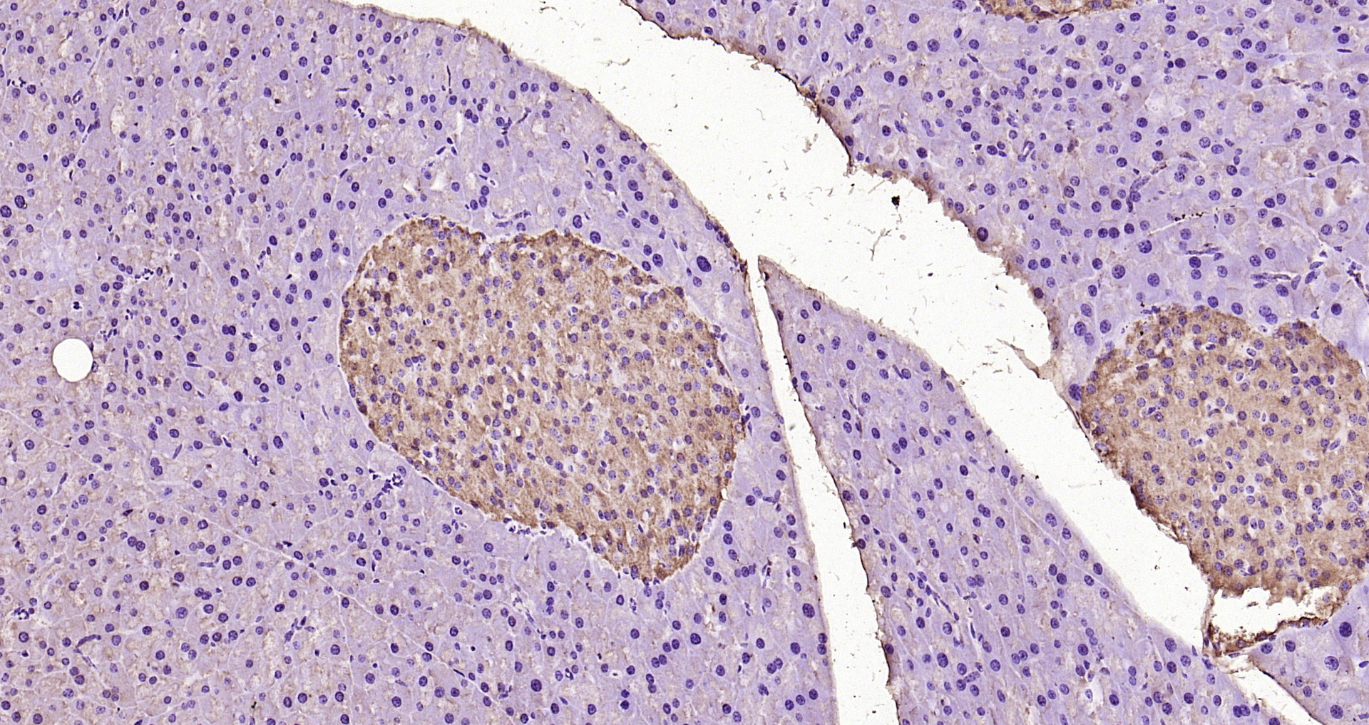 Paraformaldehyde-fixed, paraffin embedded Rat pancreas; Antigen retrieval by boiling in sodium citrate buffer (pH6.0) for 15min; Block endogenous peroxidase by 3% hydrogen peroxide for 20 minutes; Blocking buffer (normal goat serum) at 37°C for 30min; Antibody incubation with ERK2 Polyclonal Antibody, Unconjugated (bs-24463R) at 1:200 overnight at 4°C, DAB staining.