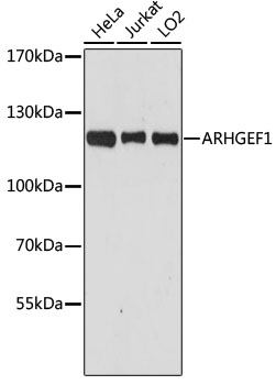 Lane 1: Hela cell lysates; Lane 2: Jurkat cell lysates; Lane 3: LO2 cell lysates probed with ARHGEF1 Polyclonal Antibody, Unconjugated (bs-55014R) at 1:1000 dilution and 4˚C overnight incubation. Followed by conjugated secondary antibody incubation at 1:20000 for 60 min at 37˚C.