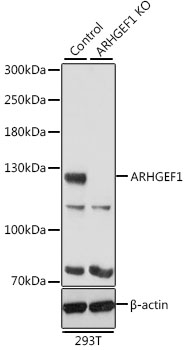 Lane 1: 293T cell lysates; Lane 2: ARHGEF1 knockout (KO) HeLa cell lysates probed with ARHGEF1 Polyclonal Antibody, Unconjugated (bs-55014R) at 1:1000 dilution and 4˚C overnight incubation. Followed by conjugated secondary antibody incubation at 1:20000 for 60 min at 37˚C.