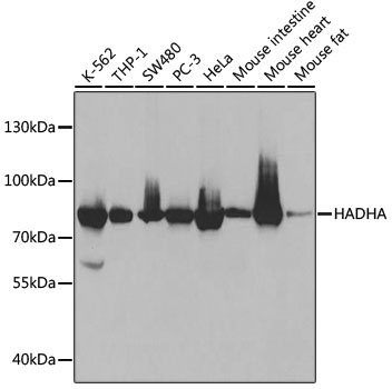 Lane 1: K562 cell lysates; Lane 2: THP-1 cell lysates; Lane 3: SW480 cell lysates; Lane 4: PC-3 cell lysates; Lane 5: Hela cell lysates; Lane 6: Mouse Intestine lysates; Lane 7: Mouse Heart lysates; Lane 8: Mouse Fat lysates probed with HADHA Polyclonal Antibody, Unconjugated (bs-55092R) at 1:1000 dilution and 4˚C overnight incubation. Followed by conjugated secondary antibody incubation at 1:20000 for 60 min at 37˚C. Lane 1: K562 cell lysates; Lane 2: THP-1 cell lysates; Lane 3: SW480 cell lysates; Lane 4: PC-3 cell lysates; Lane 5: Hela cell lysates; Lane 6: Mouse Intestine lysates; Lane 7: Mouse Heart lysates; Lane 8: Mouse Fat lysates probed with HADHA Polyclonal Antibody, Unconjugated (bs-55092R) at 1:1000 dilution and 4˚C overnight incubation. Followed by conjugated secondary antibody incubation at 1:20000 for 60 min at 37˚C.