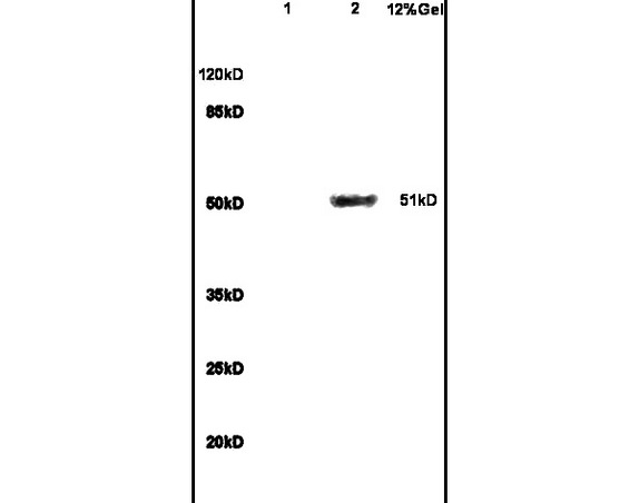 Lane 1: mouse brain lysates Lane 2: mouse liver lysates probed with Anti GCK/Glucokinase Polyclonal Antibody, Unconjugated (bs-1796R) at 1:200 in 4C. Followed by conjugation to secondary antibody (bs-0295G-HRP) at 1:3000 90min in 37C. Predicted band 51kD. Observed band size: 51kD