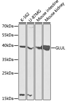 Lane 1: K562 cell lysates; Lane 2: U87-MG cell lysates; Lane 3: Mouse Intestine lysates; Lane 4: Mouse Kidney lysates probed with GLUL Polyclonal Antibody, Unconjugated (bs-55085R) at 1:1000 dilution and 4˚C overnight incubation. Followed by conjugated secondary antibody incubation at 1:20000 for 60 min at 37˚C.