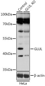 Lane 1: Hela cell lysates; Lane 2: GLUL knockout (KO) HeLa cell lysates probed with GLUL Polyclonal Antibody, Unconjugated (bs-55085R) at 1:1000 dilution and 4˚C overnight incubation. Followed by conjugated secondary antibody incubation at 1:20000 for 60 min at 37˚C.