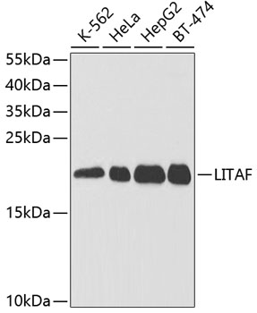 Lane 1: K562 cell lysates; Lane 2: Hela cell lysates; Lane 3: HepG2 cell lysates; Lane 4: BT-474 cell lysates probed with LITAF Polyclonal Antibody, Unconjugated (bs-55125R) at 1:1000 dilution and 4˚C overnight incubation. Followed by conjugated secondary antibody incubation at 1:20000 for 60 min at 37˚C. Lane 1: K562 cell lysates; Lane 2: Hela cell lysates; Lane 3: HepG2 cell lysates; Lane 4: BT-474 cell lysates probed with LITAF Polyclonal Antibody, Unconjugated (bs-55125R) at 1:1000 dilution and 4˚C overnight incubation. Followed by conjugated secondary antibody incubation at 1:20000 for 60 min at 37˚C.