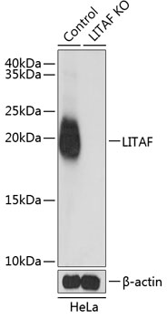 Lane 1: Hela cell lysates; Lane 2: LITAF knockout (KO) HeLa cell lysates probed with LITAF Polyclonal Antibody, Unconjugated (bs-55125R) at 1:1000 dilution and 4˚C overnight incubation. Followed by conjugated secondary antibody incubation at 1:20000 for 60 min at 37˚C. Lane 1: Hela cell lysates; Lane 2: LITAF knockout (KO) HeLa cell lysates probed with LITAF Polyclonal Antibody, Unconjugated (bs-55125R) at 1:1000 dilution and 4˚C overnight incubation. Followed by conjugated secondary antibody incubation at 1:20000 for 60 min at 37˚C.