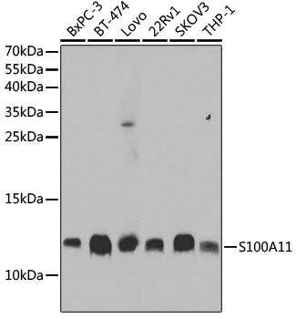Lane 1: BxPC-3 cell lysates; Lane 2: BT-474 cell lysates; Lane 3: Lovo cell lysates; Lane 4: 22Rv1 cell lysates; Lane 5: SKOV3 cell lysates; Lane 6: THP-1 cell lysates probed with S100A11 Polyclonal Antibody, Unconjugated (bs-55189R) at 1:1000 dilution and 4˚C overnight incubation. Followed by conjugated secondary antibody incubation at 1:20000 for 60 min at 37˚C.
