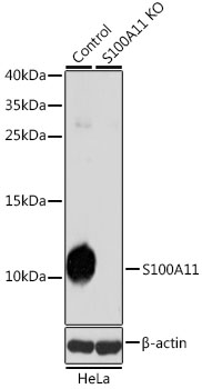 Lane 1: Hela cell lysates; Lane 2: S100A11 knockout (KO) HeLa cell lysates probed with S100A11 Polyclonal Antibody, Unconjugated (bs-55189R) at 1:1000 dilution and 4˚C overnight incubation. Followed by conjugated secondary antibody incubation at 1:20000 for 60 min at 37˚C.