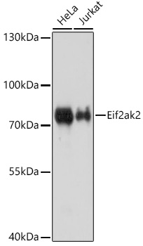 Lane 1: Hela cell lysates; Lane 2: Jurkat cell lysates probed with Eif2ak2 Polyclonal Antibody, Unconjugated (bs-55064R) at 1:1000 dilution and 4˚C overnight incubation. Followed by conjugated secondary antibody incubation at 1:20000 for 60 min at 37˚C.