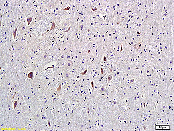 Formalin-fixed and paraffin embedded rat brain labeled with Anti-GRM5\/mGluR5 Polyclonal Antibody, Unconjugated (bs-1244R) followed by conjugation to the secondary antibody and DAB staining