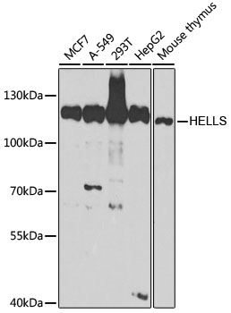 Lane 1: MCF-7 cell lysates; Lane 2: A549 cell lysates; Lane 3: 293T cell lysates; Lane 4: HepG2 cell lysates; Lane 5: Mouse thymus lysates probed with HELLS Polyclonal Antibody, Unconjugated (bs-55095R) at 1:1000 dilution and 4˚C overnight incubation. Followed by conjugated secondary antibody incubation at 1:20000 for 60 min at 37˚C. Lane 1: MCF-7 cell lysates; Lane 2: A549 cell lysates; Lane 3: 293T cell lysates; Lane 4: HepG2 cell lysates; Lane 5: Mouse thymus lysates probed with HELLS Polyclonal Antibody, Unconjugated (bs-55095R) at 1:1000 dilution and 4˚C overnight incubation. Followed by conjugated secondary antibody incubation at 1:20000 for 60 min at 37˚C.