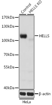 Lane 1: Hela cell lysates; Lane 2: HELLS knockout (KO) HeLa cell lysates probed with HELLS Polyclonal Antibody, Unconjugated (bs-55095R) at 1:1000 dilution and 4˚C overnight incubation. Followed by conjugated secondary antibody incubation at 1:20000 for 60 min at 37˚C. Lane 1: Hela cell lysates; Lane 2: HELLS knockout (KO) HeLa cell lysates probed with HELLS Polyclonal Antibody, Unconjugated (bs-55095R) at 1:1000 dilution and 4˚C overnight incubation. Followed by conjugated secondary antibody incubation at 1:20000 for 60 min at 37˚C.
