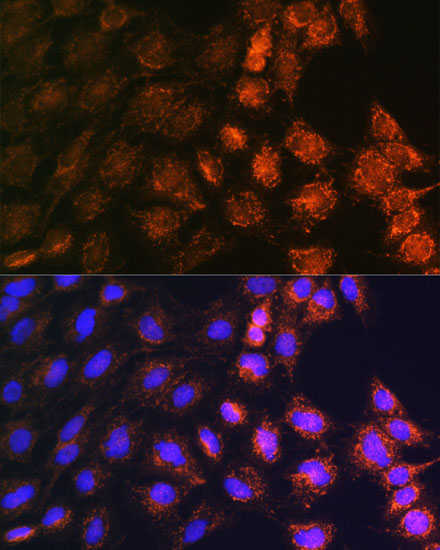 C6 cell; 4% Paraformaldehyde-fixed; Triton X-100 at room temperature for 20 min; Blocking buffer (normal goat serum, C-0005) at 37°C for 20 min; Antibody incubation with (SLC25A22) polyclonal Antibody, Unconjugated (bs-55200R) 1:100, 90 minutes at 37°C; followed by a conjugated Goat Anti-Rabbit IgG antibody at 37°C for 90 minutes, DAPI (blue, C02-04002) was used to stain the cell nuclei.