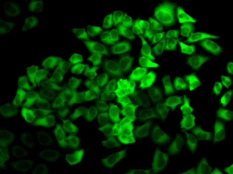 Hela cell; 4% Paraformaldehyde-fixed; Triton X-100 at room temperature for 20 min; Blocking buffer (normal goat serum, C-0005) at 37°C for 20 min; Antibody incubation with (PRDX2) polyclonal Antibody, Unconjugated (bs-55172R) 1:100, 90 minutes at 37°C; followed by a conjugated Goat Anti-Rabbit IgG antibody at 37°C for 90 minutes.