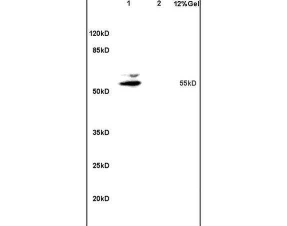 Lane 1: mouse brain lysates Lane 2: mouse intestine lysates probed with Anti Matrilin 1 Polyclonal Antibody, Unconjugated (bs-1976R) at 1:200 in 4C. Followed by conjugation to secondary antibody (bs-0295G-HRP) at 1:3000 90min in 37C. Predicted band 55kD. Observed band size: 55kD