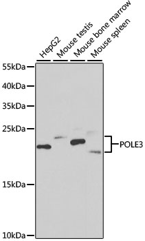 Lane 1: HepG2 cell lysates; Lane 2: Mouse Testis lysates; Lane 3: Mouse bone marrow lysates; Lane 4: Mouse spleen lysates probed with POLE3 Polyclonal Antibody, Unconjugated (bs-55169R) at 1:1000 dilution and 4˚C overnight incubation. Followed by conjugated secondary antibody incubation at 1:20000 for 60 min at 37˚C.