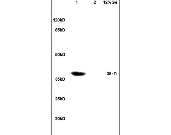 Lane 1: rat heart lysates Lane 2: rat embryo lysates probed with Anti Coxsackie Adenovirus Receptor Polyclonal Antibody, Unconjugated (bs-2389R) at 1:200 in 4C. Followed by conjugation to secondary antibody (bs-0295G-HRP) at 1:3000 90min in 37C. Predicted band 38kD. Observed band size: 38kD