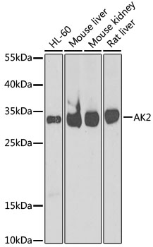 Lane 1: HL-60 cell lysates; Lane 2: Mouse Liver lysates; Lane 3: Mouse Kidney lysates; Lane 4: Rat Liver lysates probed with AK2 Polyclonal Antibody, Unconjugated (bs-55004R) at 1:1000 dilution and 4˚C overnight incubation. Followed by conjugated secondary antibody incubation at 1:20000 for 60 min at 37˚C.