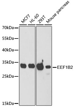 Lane 1: MCF-7 cell lysates; Lane 2: HL-60 cell lysates; Lane 3: 293T cell lysates; Lane 4: Mouse pancreas lysates probed with EEF1B2 Polyclonal Antibody, Unconjugated (bs-55059R) at 1:1000 dilution and 4˚C overnight incubation. Followed by conjugated secondary antibody incubation at 1:20000 for 60 min at 37˚C.