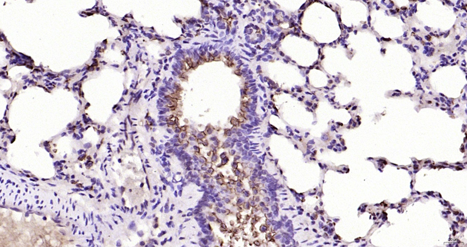 Paraformaldehyde-fixed, paraffin embedded Rat lung; Antigen retrieval by boiling in sodium citrate buffer (pH6.0) for 15min; Block endogenous peroxidase by 3% hydrogen peroxide for 20 minutes; Blocking buffer (normal goat serum) at 37°C for 30min; Antibody incubation with MUC1 Polyclonal Antibody, Unconjugated (bs-1497R) at 1:200 overnight at 4°C, DAB staining.
