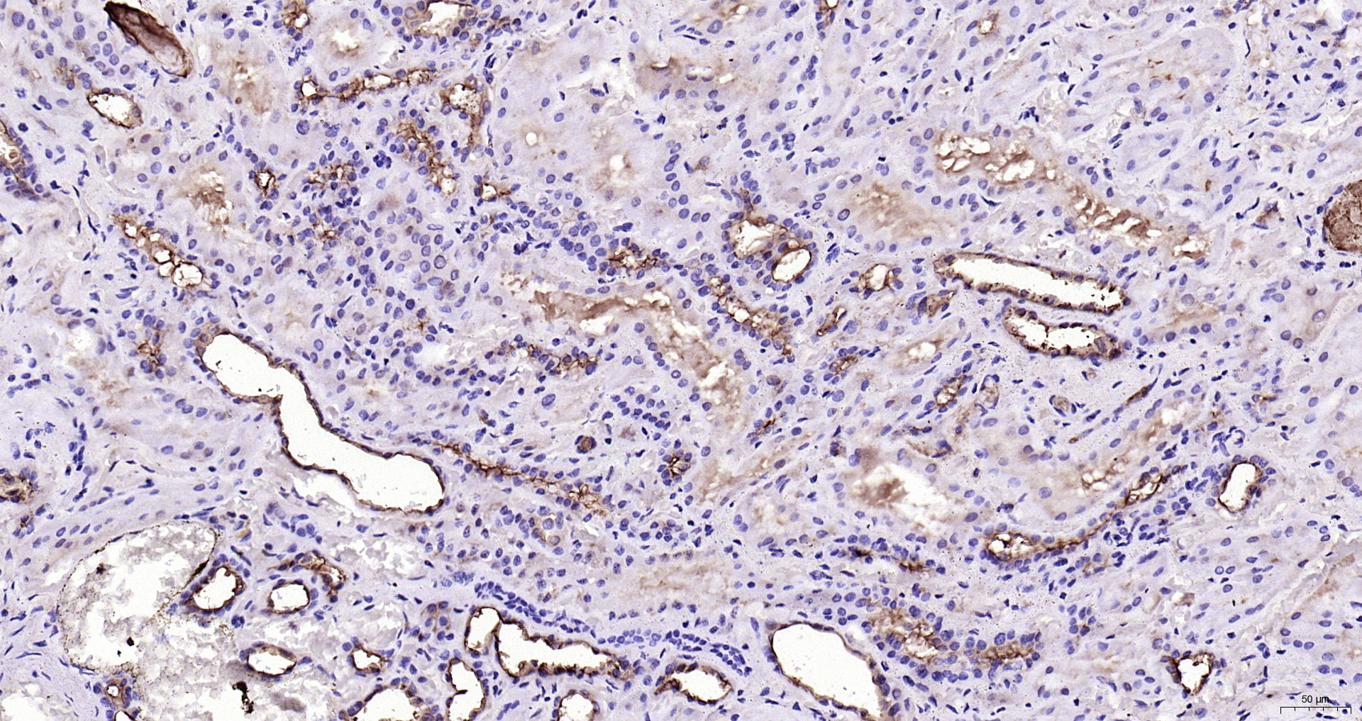 Paraformaldehyde-fixed, paraffin embedded Human kidney; Antigen retrieval by boiling in sodium citrate buffer (pH6.0) for 15min; Block endogenous peroxidase by 3% hydrogen peroxide for 20 minutes; Blocking buffer (normal goat serum) at 37°C for 30min; Antibody incubation with MUC1 Polyclonal Antibody, Unconjugated (bs-1497R) at 1:200 overnight at 4°C, DAB staining.