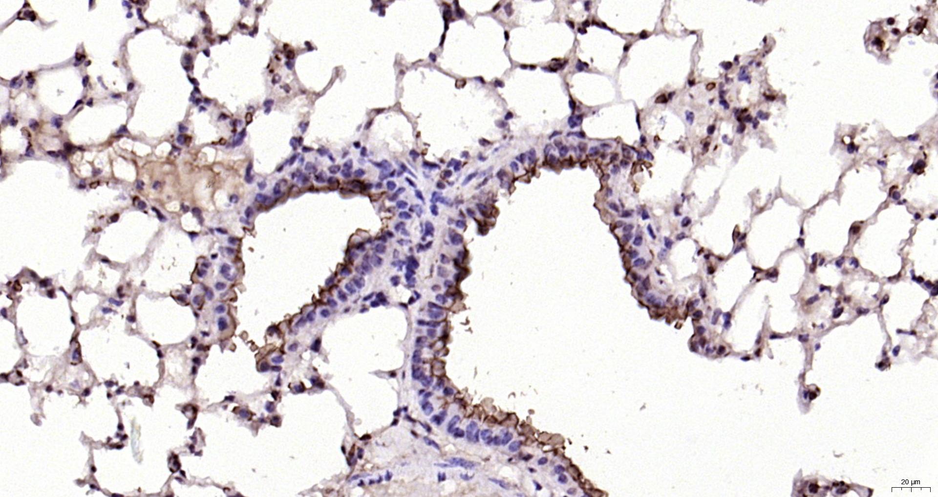 Paraformaldehyde-fixed, paraffin embedded Mouse lung; Antigen retrieval by boiling in sodium citrate buffer (pH6.0) for 15min; Block endogenous peroxidase by 3% hydrogen peroxide for 20 minutes; Blocking buffer (normal goat serum) at 37°C for 30min; Antibody incubation with MUC1 Polyclonal Antibody, Unconjugated (bs-1497R) at 1:200 overnight at 4°C, DAB staining.