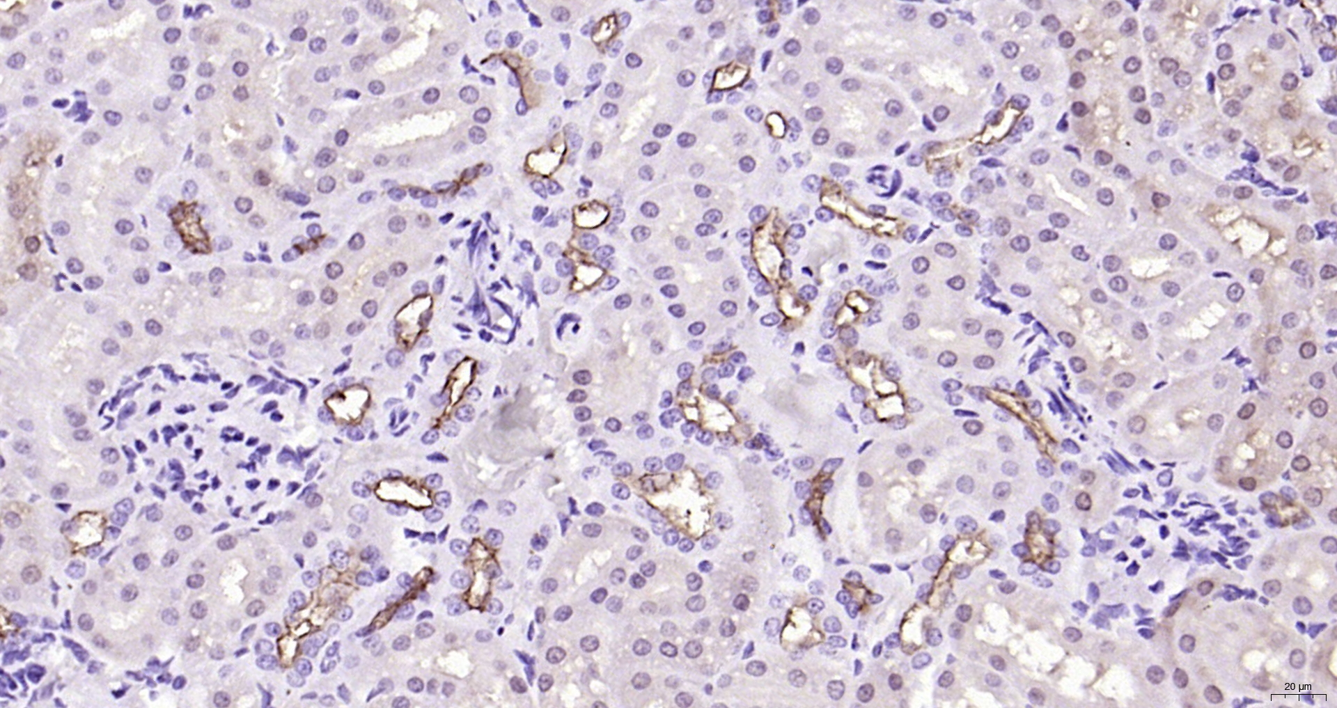 Paraformaldehyde-fixed, paraffin embedded Rat kidney; Antigen retrieval by boiling in sodium citrate buffer (pH6.0) for 15min; Block endogenous peroxidase by 3% hydrogen peroxide for 20 minutes; Blocking buffer (normal goat serum) at 37°C for 30min; Antibody incubation with MUC1 Polyclonal Antibody, Unconjugated (bs-1497R) at 1:200 overnight at 4°C, DAB staining.