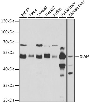 Lane 1: MCF-7 cell lysates; Lane 2: Hela cell lysates; Lane 3: SW620 cell lysates; Lane 4: HepG2 cell lysates; Lane 5: Jurkat cell lysates; Lane 6: Rat kidney lysates; Lane 7: Mouse Liver lysates probed with XIAP Polyclonal Antibody, Unconjugated (bs-55223R) at 1:1000 dilution and 4˚C overnight incubation. Followed by conjugated secondary antibody incubation at 1:20000 for 60 min at 37˚C.