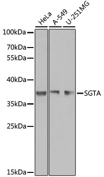 Lane 1: Hela cell lysates; Lane 2: A549 cell lysates; Lane 3: U-251MG cell lysates probed with SGTA Polyclonal Antibody, Unconjugated (bs-55197R) at 1:1000 dilution and 4˚C overnight incubation. Followed by conjugated secondary antibody incubation at 1:20000 for 60 min at 37˚C.