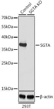 Lane 1: 293T cell lysates; Lane 2: SGTA knockout (KO) 293T cell lysates probed with SGTA Polyclonal Antibody, Unconjugated (bs-55197R) at 1:1000 dilution and 4˚C overnight incubation. Followed by conjugated secondary antibody incubation at 1:20000 for 60 min at 37˚C.