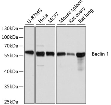 Lane 1: U-87MG cell lysates; Lane 2: Hela cell lysates; Lane 3: MCF-7 cell lysates; Lane 4: Mouse Spleen lysates; Lane 5: Rat ovary lysates; Lane 6: Rat Lung cell lysates probed with Beclin 1 Polyclonal Antibody, Unconjugated (bs-55024R) at 1:1000 dilution and 4˚C overnight incubation. Followed by conjugated secondary antibody incubation at 1:20000 for 60 min at 37˚C.