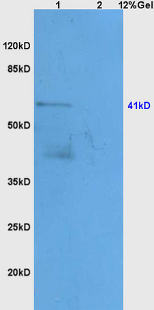 Lane 1: mouse heart lysates Lane 2: mouse kidney lysates probed with Anti APOA4 Polyclonal Antibody, Unconjugated (bs-2688R) at 1:200 in 4˚C. Followed by conjugation to secondary antibody (bs-0295G-HRP) at 1:3000 90min in 37˚C. Predicted band 41kD. Observed band size: 41kD