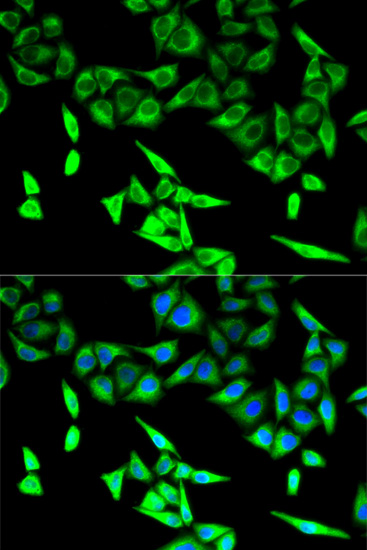 U2-OS cell; 4% Paraformaldehyde-fixed; Triton X-100 at room temperature for 20 min; Blocking buffer (normal goat serum, C-0005) at 37°C for 20 min; Antibody incubation with (HADHA) polyclonal Antibody, Unconjugated (bs-55092R) 1:100, 90 minutes at 37°C; followed by a conjugated Goat Anti-Rabbit IgG antibody at 37°C for 90 minutes, DAPI (blue, C02-04002) was used to stain the cell nuclei. U2-OS cell; 4% Paraformaldehyde-fixed; Triton X-100 at room temperature for 20 min; Blocking buffer (normal goat serum, C-0005) at 37°C for 20 min; Antibody incubation with (HADHA) polyclonal Antibody, Unconjugated (bs-55092R) 1:100, 90 minutes at 37°C; followed by a conjugated Goat Anti-Rabbit IgG antibody at 37°C for 90 minutes, DAPI (blue, C02-04002) was used to stain the cell nuclei.