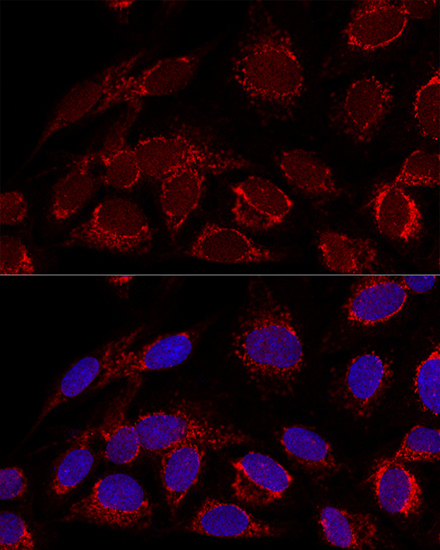 U2-OS cell; 4% Paraformaldehyde-fixed; Triton X-100 at room temperature for 20 min; Blocking buffer (normal goat serum, C-0005) at 37°C for 20 min; Antibody incubation with (HADHA) polyclonal Antibody, Unconjugated (bs-55092R) 1:100, 90 minutes at 37°C; followed by a conjugated Goat Anti-Rabbit IgG antibody at 37°C for 90 minutes, DAPI (blue, C02-04002) was used to stain the cell nuclei. U2-OS cell; 4% Paraformaldehyde-fixed; Triton X-100 at room temperature for 20 min; Blocking buffer (normal goat serum, C-0005) at 37°C for 20 min; Antibody incubation with (HADHA) polyclonal Antibody, Unconjugated (bs-55092R) 1:100, 90 minutes at 37°C; followed by a conjugated Goat Anti-Rabbit IgG antibody at 37°C for 90 minutes, DAPI (blue, C02-04002) was used to stain the cell nuclei.